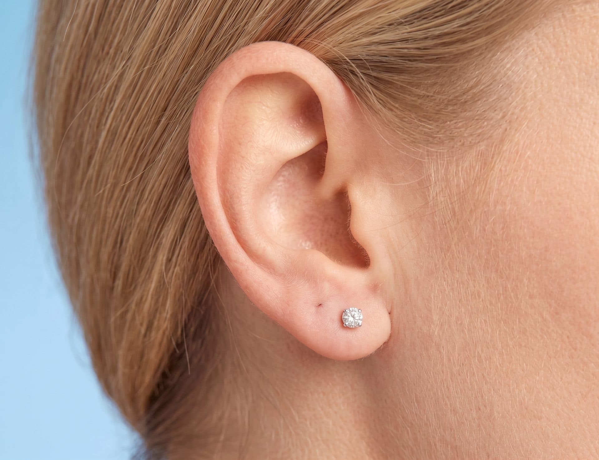 B. Plastie du lobe de l'oreille