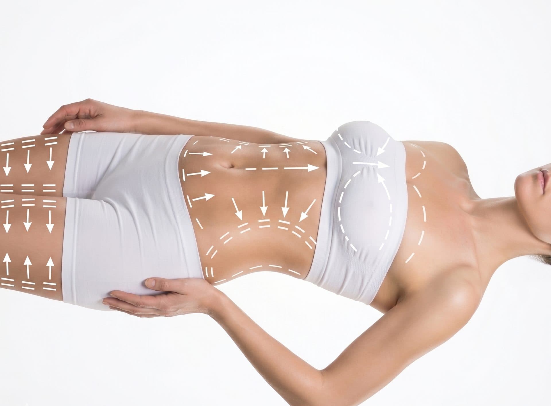 Bodylift